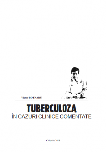 Tuberculoza