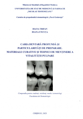 caria dentara