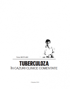 Tuberculoza