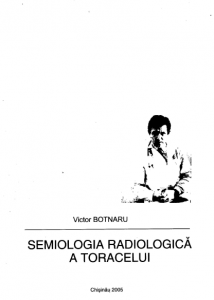semiologia radiologica a toracelui